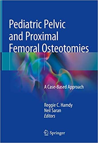 کتاب پدیاتریک پلویک اند&nbsp;پروگزیمال&nbsp;فمورال استئوتومیز Pediatric Pelvic and Proximal Femoral Osteotomies, 1st Edition2019