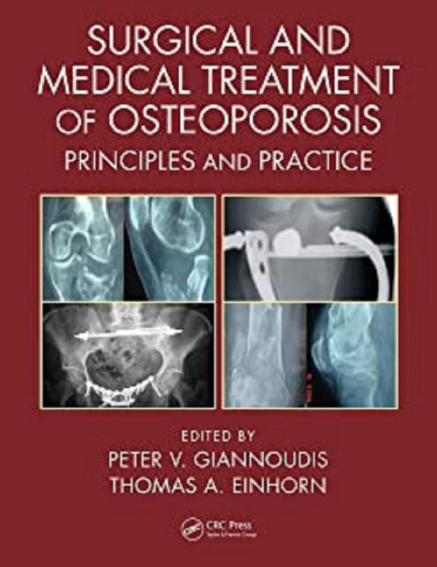کتاب سرجیکال اند مدیکال ترینمنت آف استئوپوروزیس&nbsp;Surgical and Medical Treatment of Osteoporosis: Principles and Practice 1st Edit