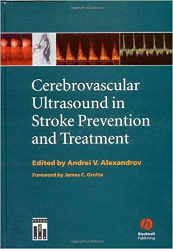 کتاب زبان سربرووسکولار التراسوند این استروک پریونشن اند تریتمنت Cerebrovascular Ultrasound in Stroke Prevention and Treatment