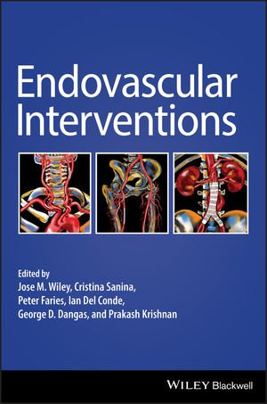 کتاب اندوواسکولار اینترونشنز Endovascular Interventions