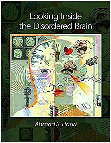 کتاب لوکینگ اینساید د دیس اردرد برین  Looking Inside the Disordered Brain