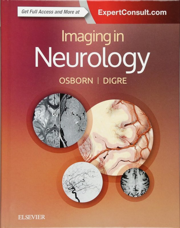 کتاب پزشکی تصویربرداری در نورولوژی Imaging in Neurology
