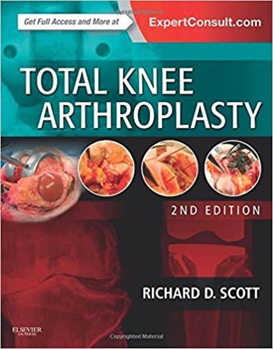 کتاب توتال نی آرتروپلاستی Total Knee Arthroplasty, 2nd Edition2014