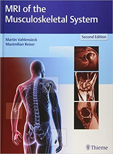 کتاب ام آر آی آف ماسکلواسکلتال سیستم MRI of the Musculoskeletal System, 2nd Edition2018