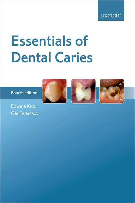 کتاب اسنشالز آف دنتال کریز Essentials of Dental Caries