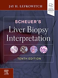 کتاب لیور بیوپسی اینترپرتیشن Scheuer’s Liver Biopsy Interpretation 10th Edition2020